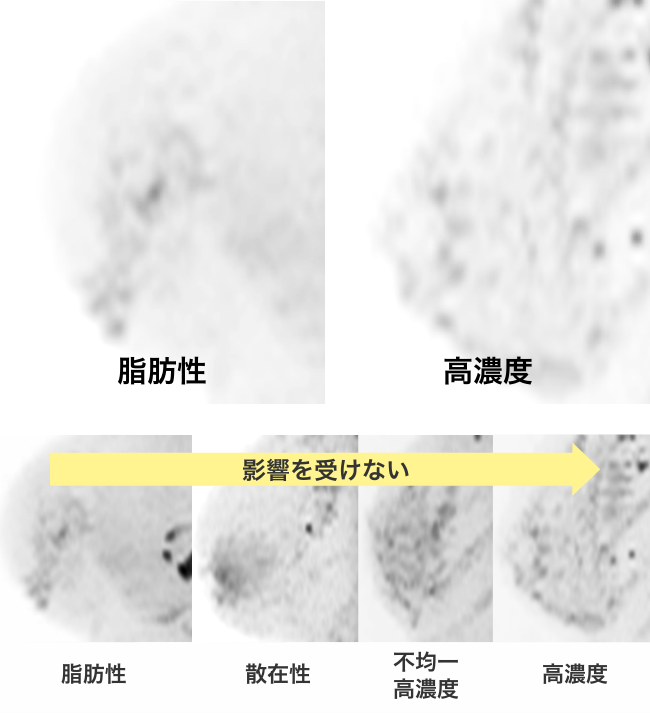 MRI検査での見え方の違い